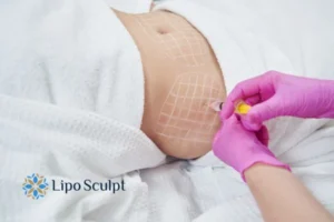 Are The Results From Aqualyx Permanent? 1 Do you want to know how long Aqualyx Ilkeston results last?